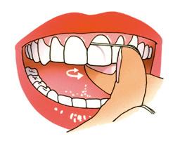 hygiène dentaire etape 3
