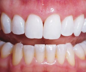 hygiène dentaire gencives saines